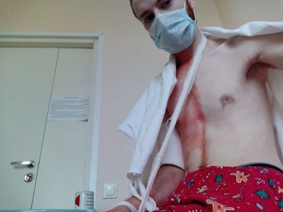 Давид Френкель в больнице после операции. Фото: Давидом Френкель / Такие дела